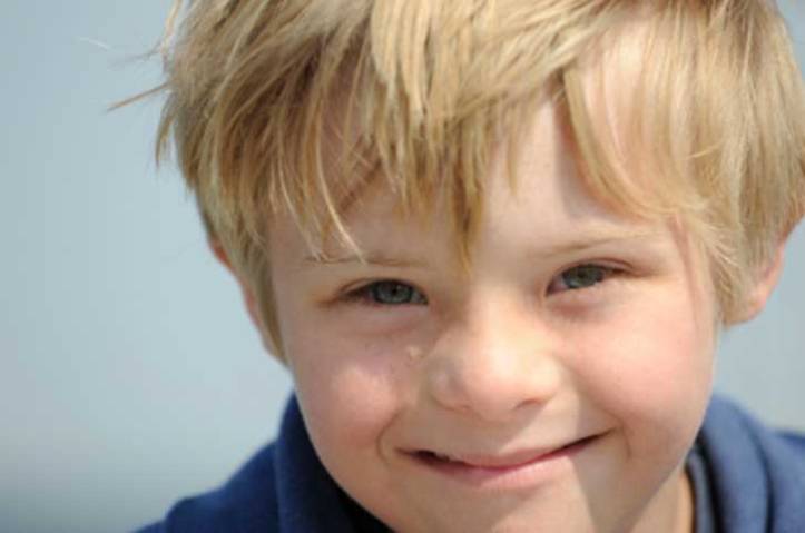 niño rubio síndrome down upsocl